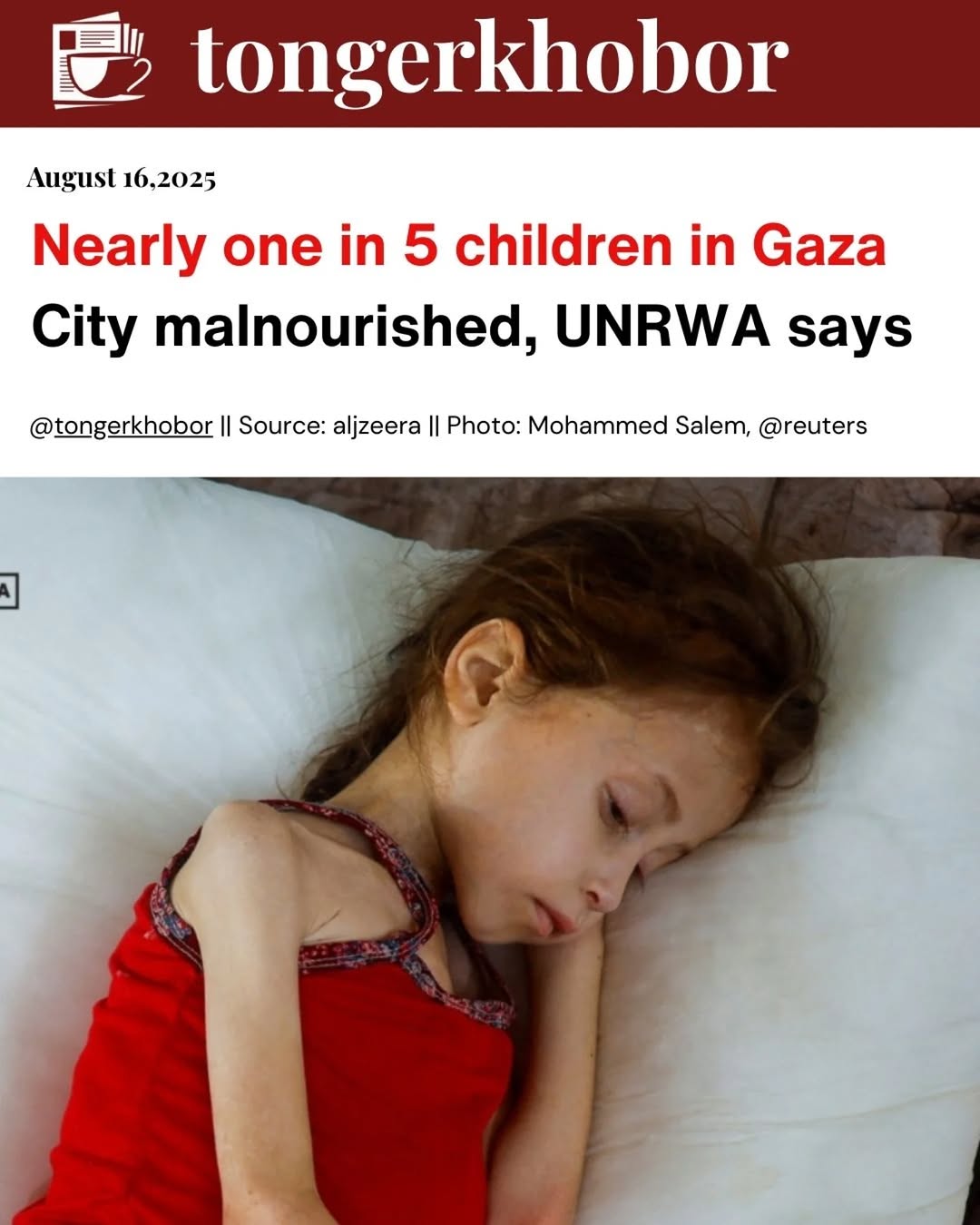 The UN agency for Palestinian refugees says malnutrition in #Gaza City has reached 21.