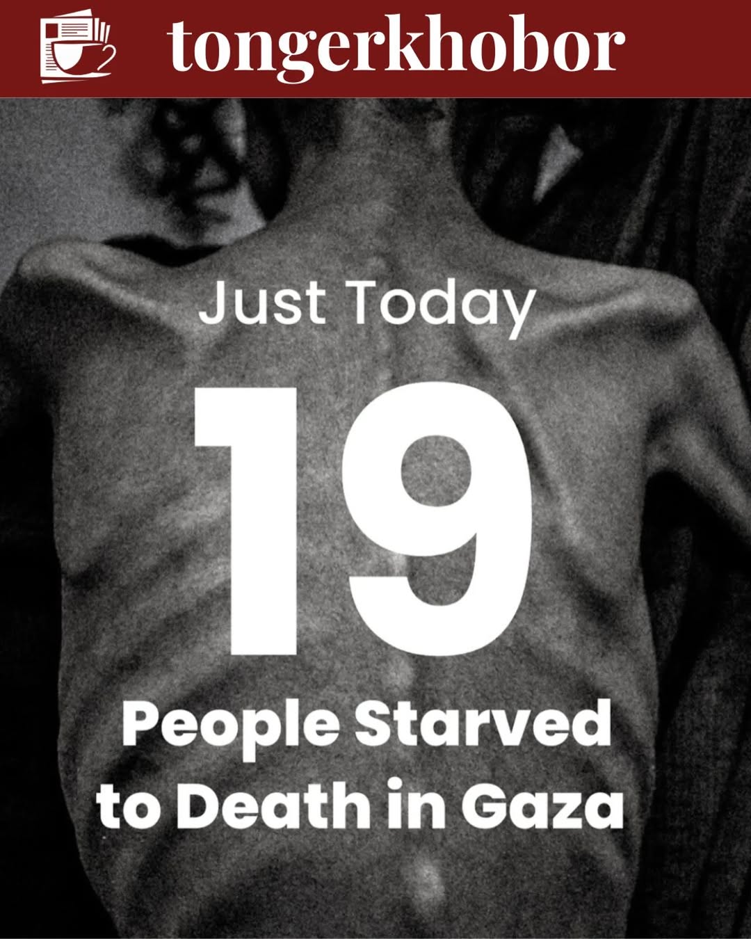 Gaza's Ministry of Health reported 19 famine deaths, most of them children.