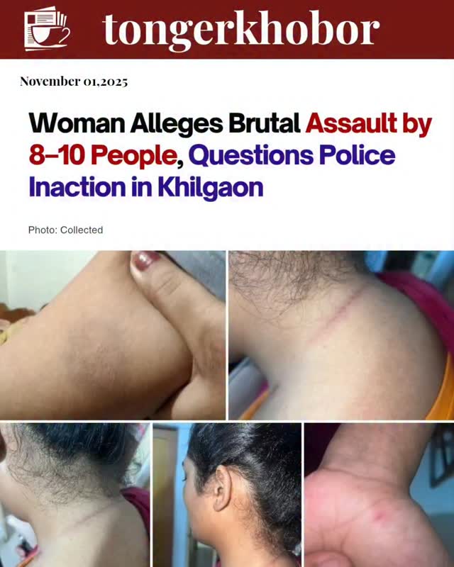 A woman from Dhaka claims she was physically assaulted and harassed by a group of 8–10 people inside her home during the day, while authorities allege...