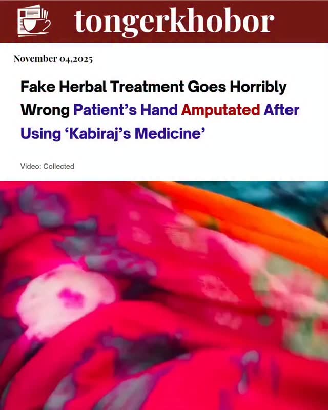 A heartbreaking case has emerged where a woman lost her hand after applying a so-called Kabiraj’s (traditional healer’s) herbal medicine.
